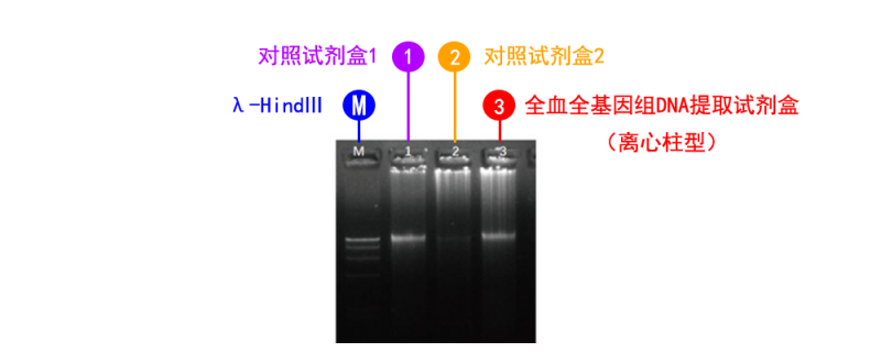 全血全基因组 DNA 提取试剂盒（离心柱型）